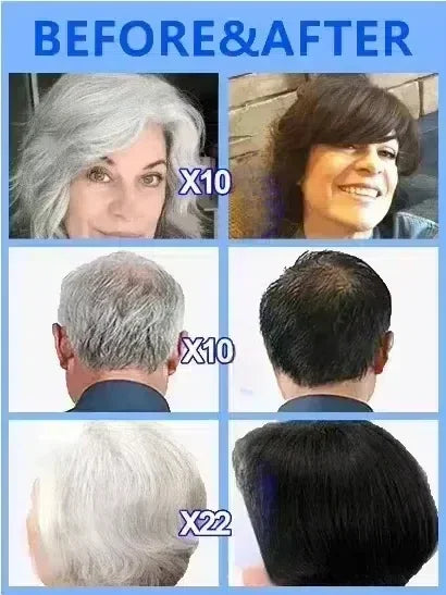 Remove gray hair and restore natural hair color.